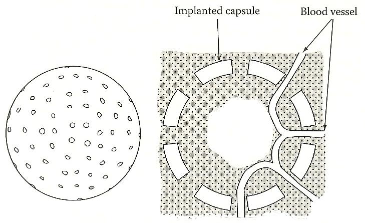 Interstitial Pressure Capsules are implanted subcutaneously Tissue and vascular system grow into the inside of