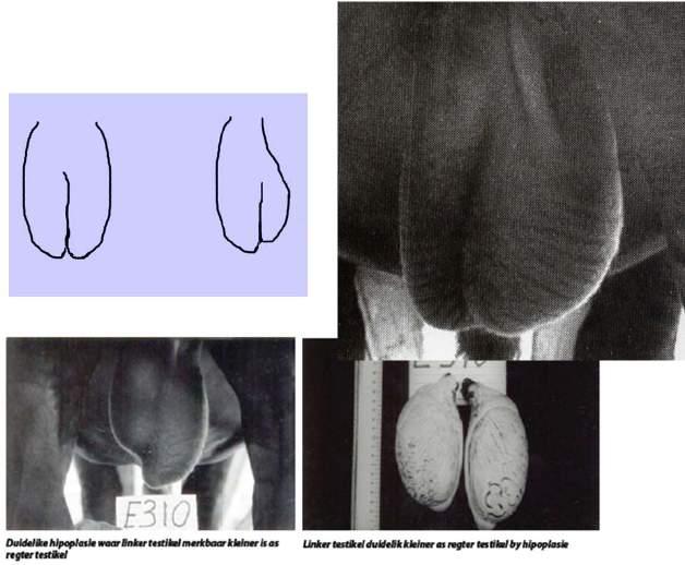 Male Reproductive Organs: Scrotum and Testes P5