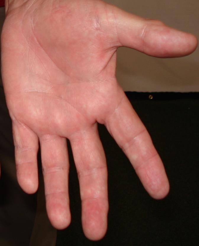 Hand Definitions Left Hand H e e l P a Thumb Pad The left hand Grip Line is defined as a line from the middle knuckle of