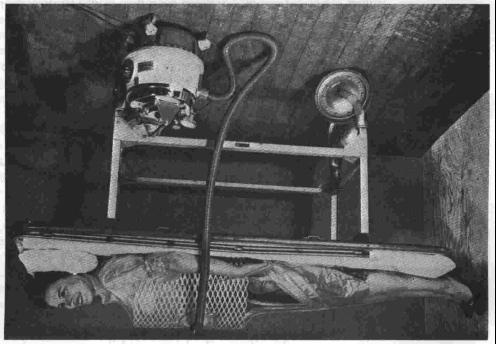 Figure 2 rendition of an early negative pressure device Iron lungs are still in use today, despite being bulky, difficult to clean and sterilize, and problems with nursing care.