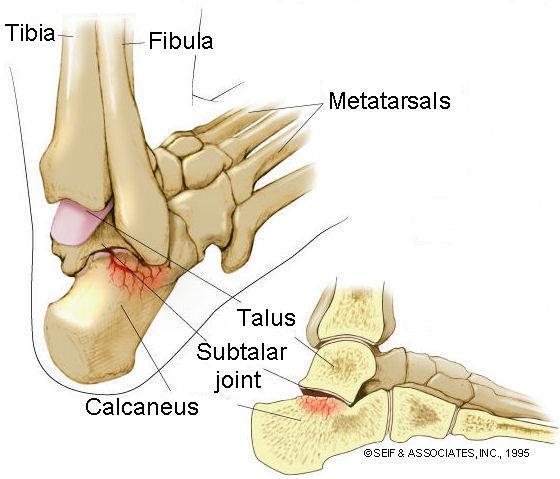 Figure 30: The musculoskeletal model with platform # The subtalar joint is a joint of the rear foot and is also known as the talocalcaneal joint.