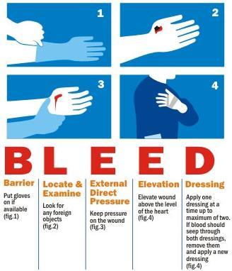 Stop Bleeding Bleeding 1. Apply direct pressure on the cut or wound with a clean cloth, tissue, or piece of gauze until bleeding stops. 2. If blood soaks through the material, don t remove it.