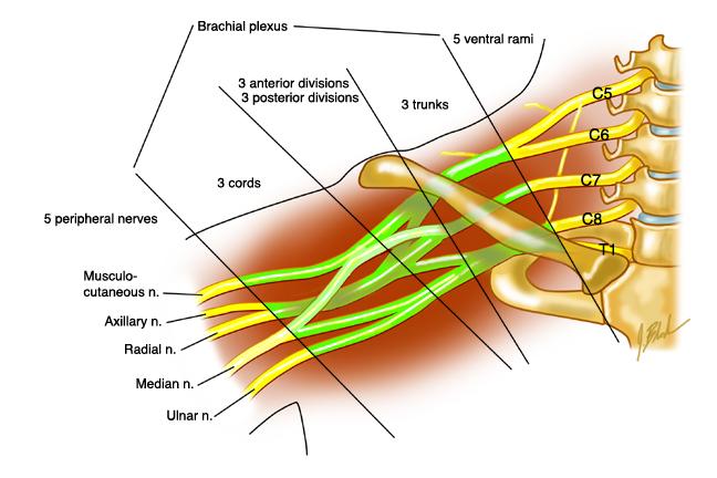 There are two main lateral flexion injury mechanisms: traction and compression. In a traction injury, the head is flexed laterally, and the brachial plexus ipsilateral to the impact is stretched.