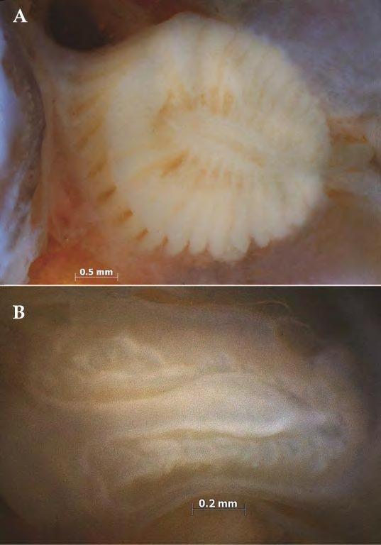 FIGURES Figure 1. Nasal lamellae. A. Well developed in Micropterus salmoides: USNM 366392, 86.8 mm SL. B.