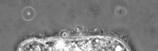 Miracidium of Schistosoma mansoni caught in the act of hatching Miracidium of Schistosoma