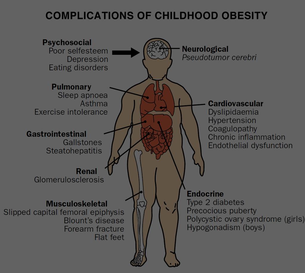 How Childhood Obesity affects Joint