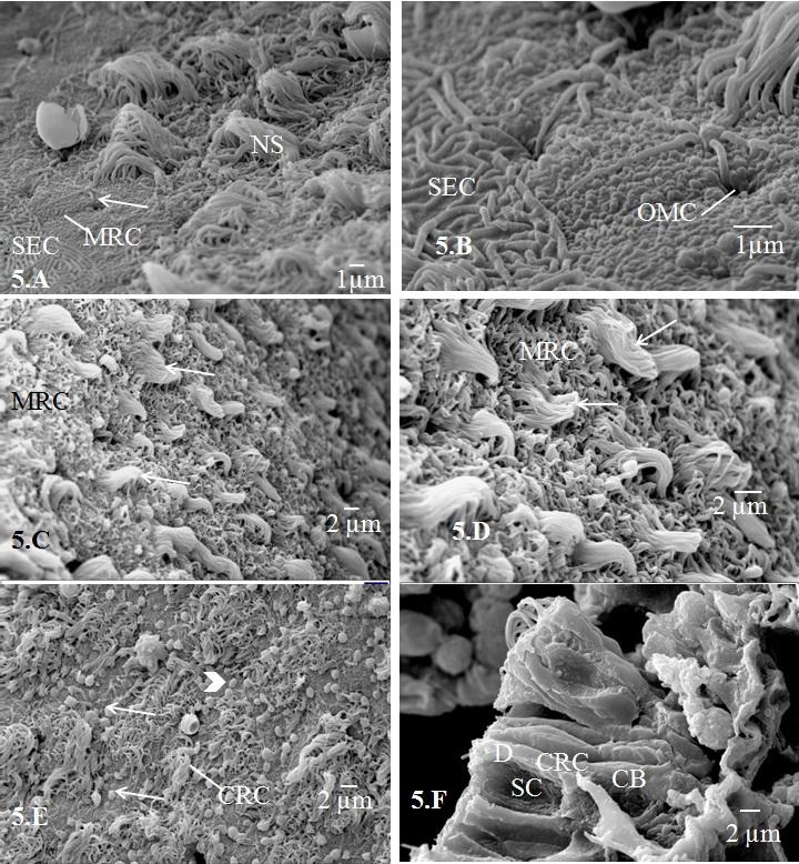 Samajdar et al. Int. J. Pure Appl. Zool., 4(2): 134-141, 2016 Figure-5: SEM of the apical surface of the olfactory sensory epithelium of Labeo bata. (5.