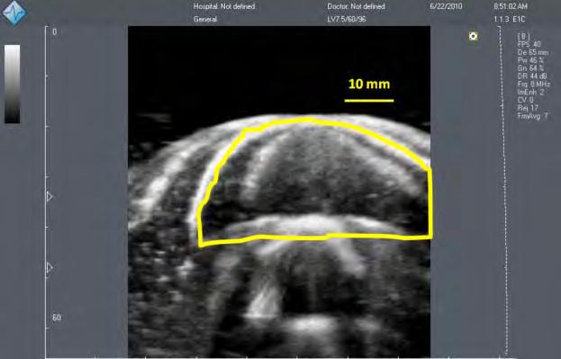 Figure 3. Ultrasound image of pre-spawning white bass female collected during June 2010 spawning activities. Outline indicates area containing the ovary. Objective 2.