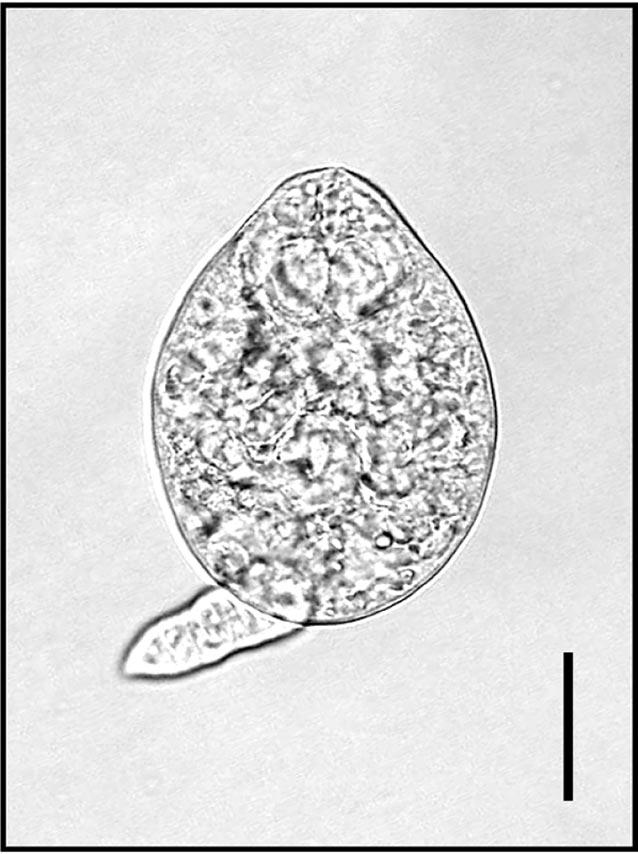 CHOI ET AL. CERCARIAE OF ECHINOCHASMUS JAPONICUS 237 61.3 1.7 m at day 4 PI (Fig. 4A).