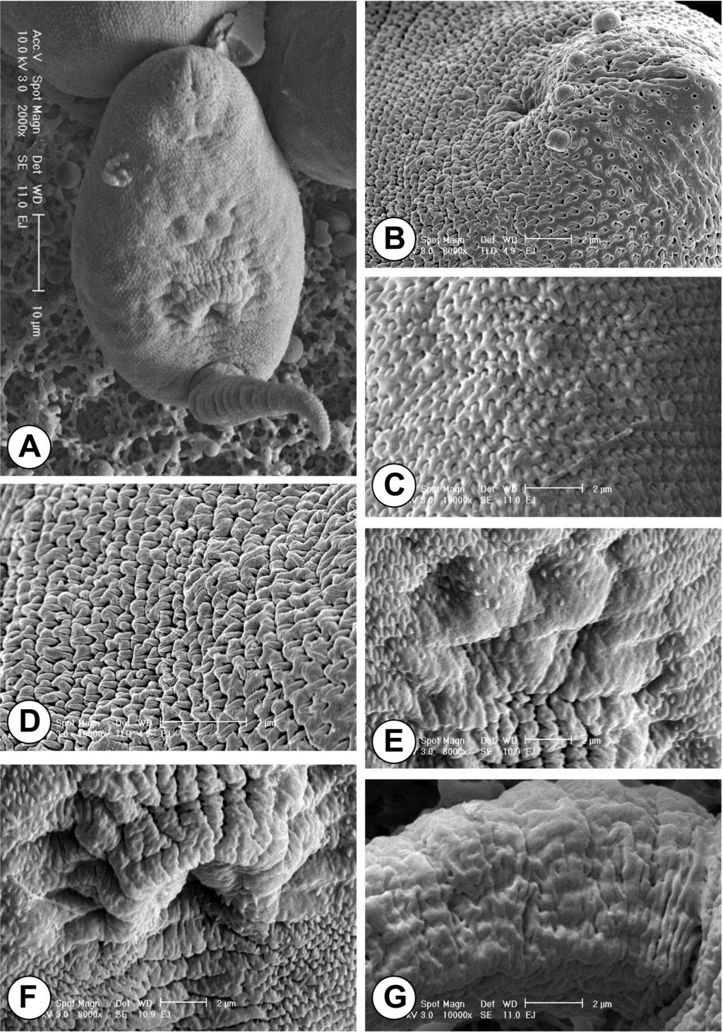 238 THE JOURNAL OF PARASITOLOGY, VOL. 92, NO. 2, APRIL 2006 FIGURE 2. SEM observations of the ventral surface of Echinochasmus japonicus cercariae. (A) Whole ventral view. (B) Oral sucker.