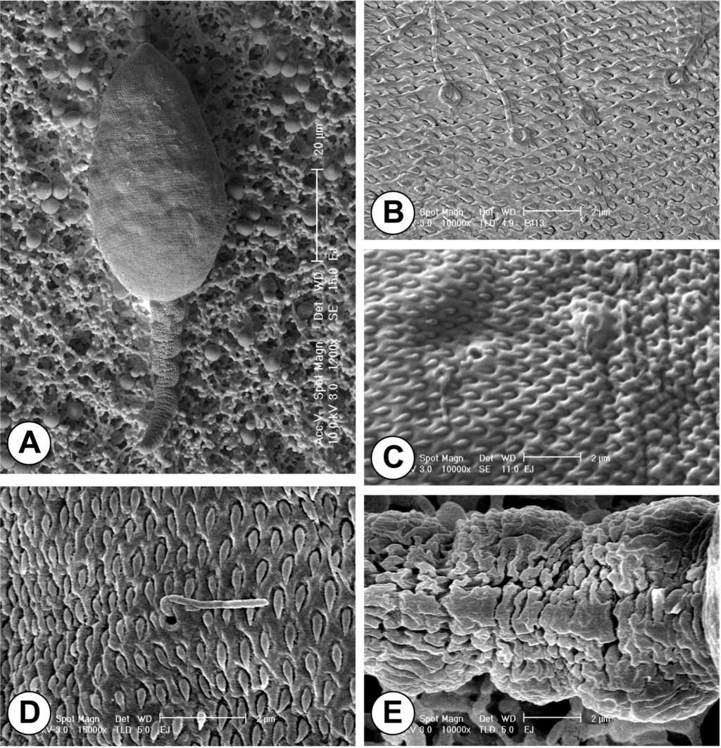CHOI ET AL. CERCARIAE OF ECHINOCHASMUS JAPONICUS 239 FIGURE 3. SEM observations of the dorsal surface of Echinochasmus japonicus cercariae. (A) Whole dorsal view.