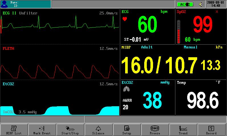 Three waveforms display mode: PATIENT NAME AND ID NUMBER ALARM INFORMATION COLUMN POWER