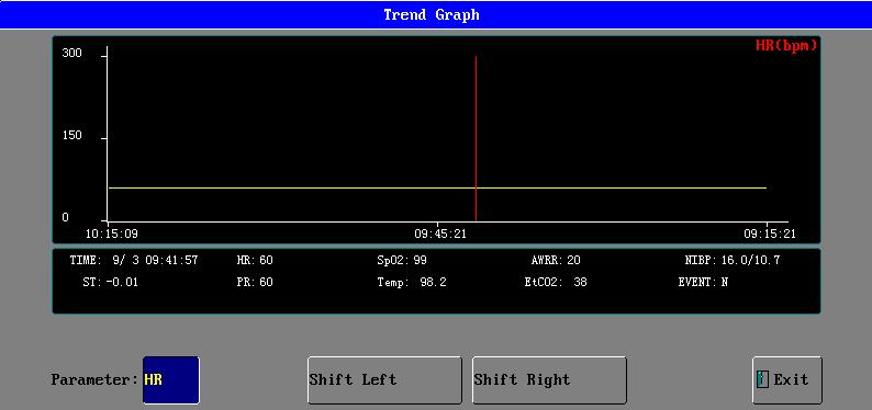 TREND GRAPH ANALYSIS TREND GRAPH ANALYSIS ADMITTANCE To choose the Trend Graph Analysis on the trend management menu, click the trend graph button to open the trend graph interface like the graph