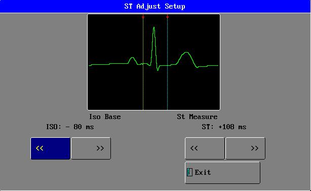 ISO(Base Point) Set the baseline point, its adjustable range is 508ms~ 4ms, the default value is 80ms, it shows that the reference point is the position 80ms before the peak of R- wave locates.