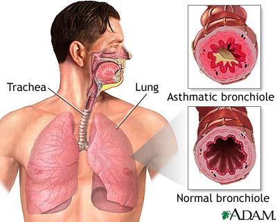 SpecificRespiratory Conditions Chronic