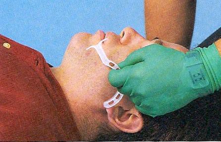 Inserting An Oral Airway Select airway or
