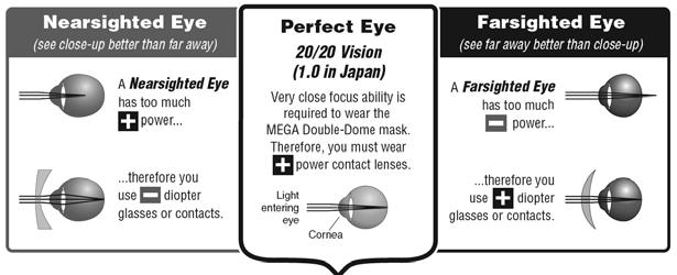 A person who is nearsighted has a thicker than normal cornea, just like a camera behind a dome port. This naturally nearsighted eye has excess positive power attached.