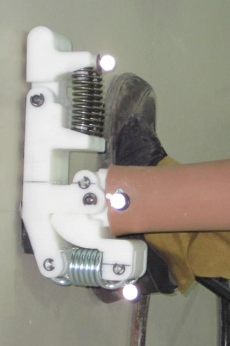 The Jaipur Foot is typically attached to plastic sockets fitted at BMVSS by heating the bottom of the sockets, sliding them over the ankle block of the foot, and securing the foot in place with four