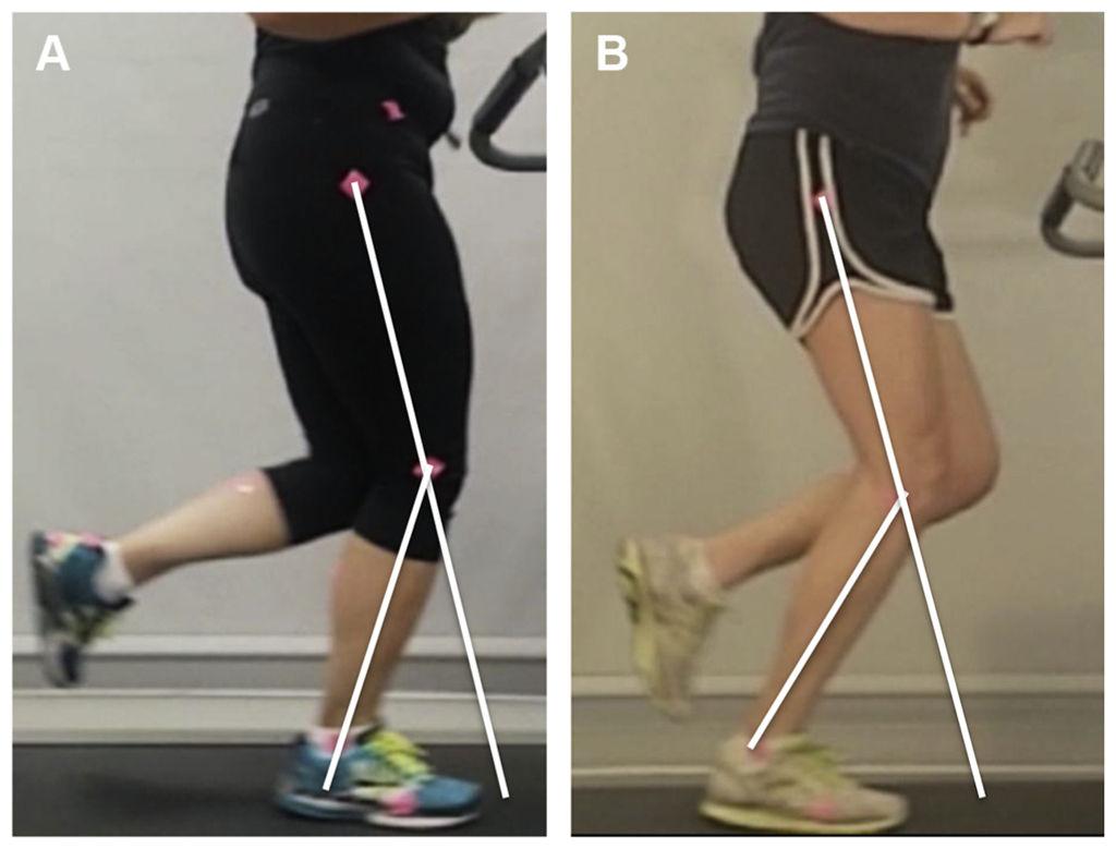 Souza Page 20 Fig. 5. Knee flexion during stance.