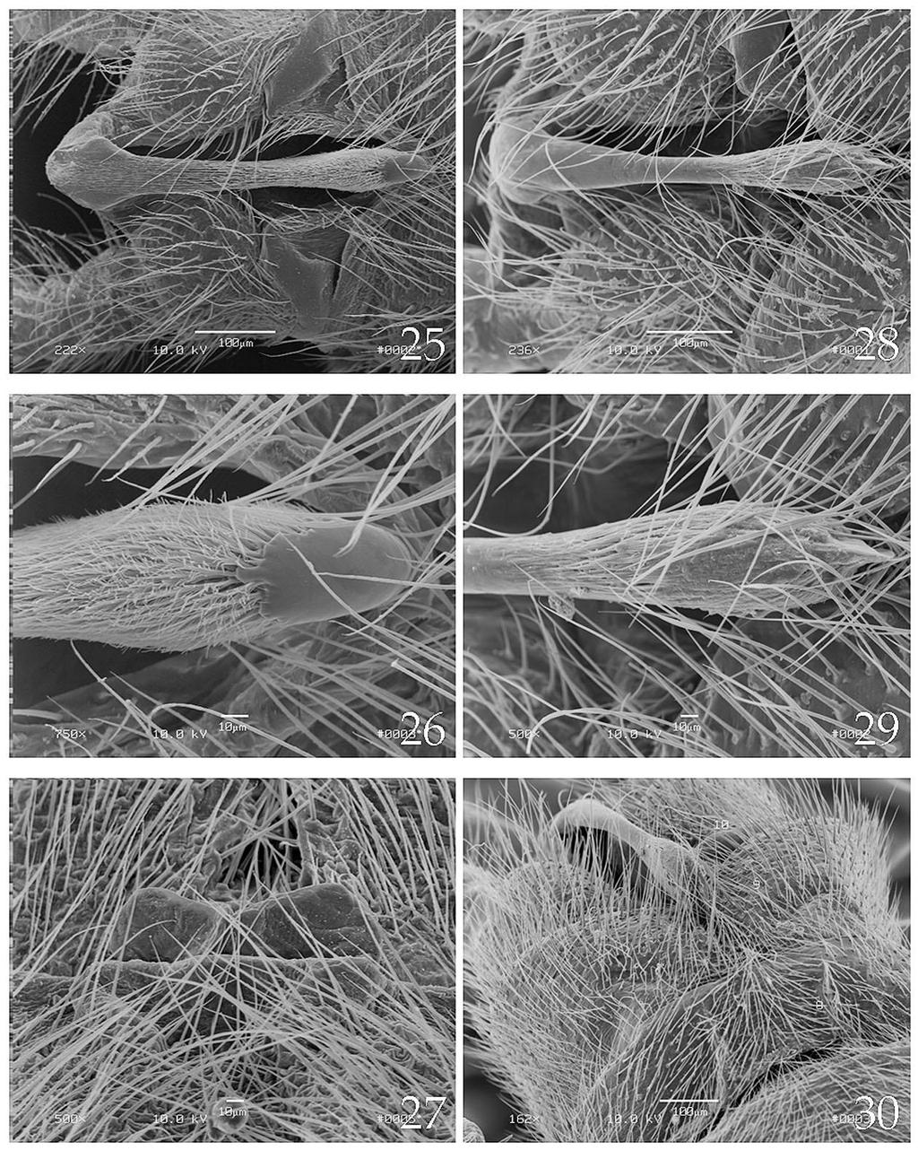 Figs. 25-30. Scanning electron micrographs of male genitalia. Sweltsa nikkoensis, Russia, p. Kedrovaja, Zapovednik Kedrovaja Pad, 14 May 2002, V. Teslenko det. (25-27). 25. Male terminalia, dorsal.