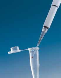 Pipette shafts/manifold are entirely autoclavable at 121 ºC (2 bar), acc. DN EN 285.