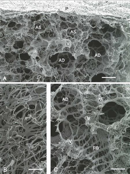 AS =alveolar sac P=pleura V=blood vessel Continuum of elastin fiber network (scale bar 200 μm) Elastin fiber network in the outer surface of the pleura (scale bar
