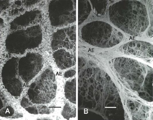 Collagen fiber network in rat lung Collapsed Inflated AE =alveolar