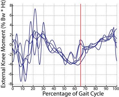 Figure 3.9: Knee moment for five gait cycles for a) a healthy subject and b) SCI patient. The red vertical line indicated toe-off.