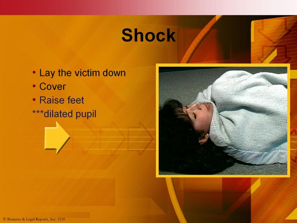 In cases where a person has lost a lot of blood, a condition known as shock can develop. Shock is the body s way of reacting to severe injury.