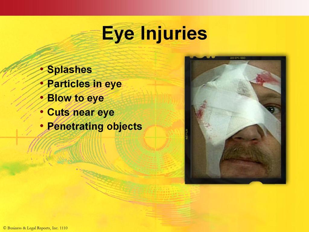 Slide Show Notes Eye injuries are a common workplace medical emergency. Eye protection can prevent most injuries.