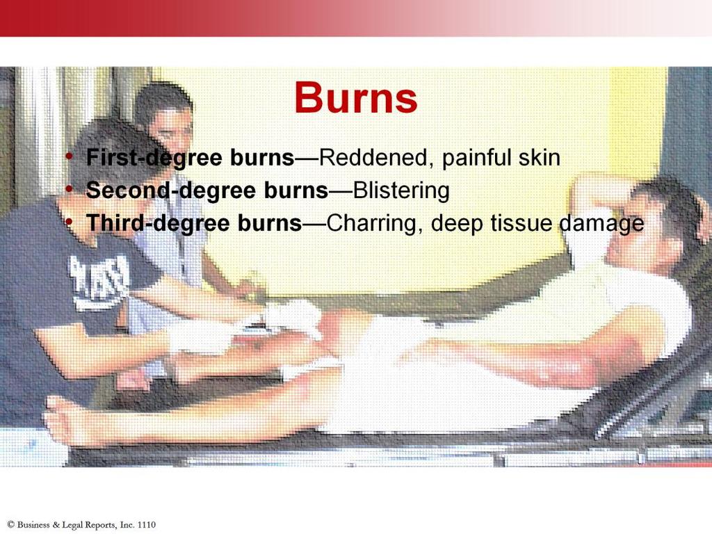 Burns are another common workplace hazard. You can be burned by hot surfaces, hot materials, or by the properties of certain materials. First aid for burns depends on the degree of the burn.