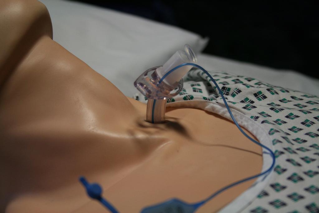Day-to-day management of Tracheostomies & Laryngectomies Decannulation The removal of a tracheostomy should occur as soon as there is no further need for it to remain in-situ.