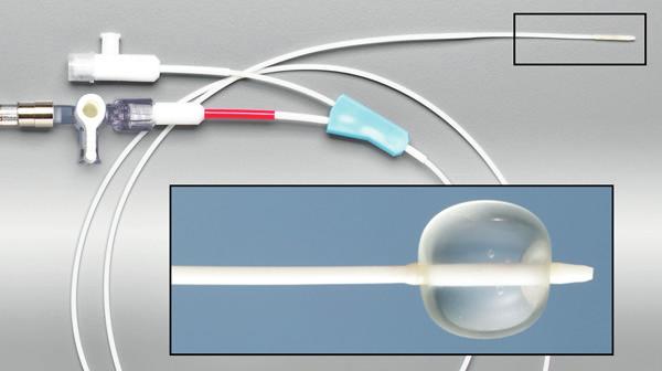 First, the procedure doctor will check the suspected airways to identify the location of the air leak by inflating a small balloon (See Figure 7) that goes through the bronchoscope.
