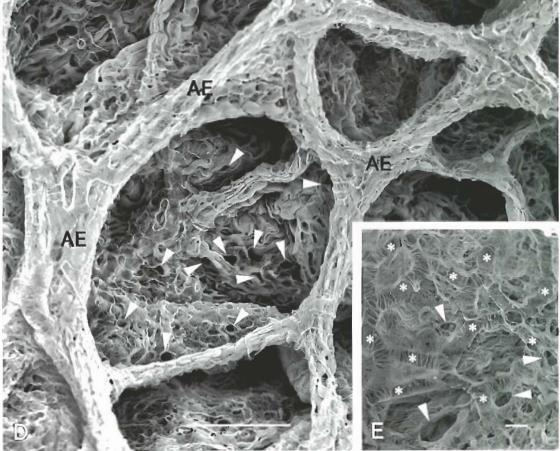 Electron micrographs of the collagen fibre network