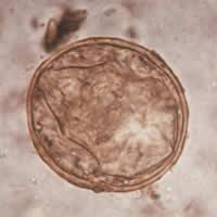 Laboratory Diagnosis: Microscopic identification of eggs in