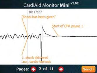With CardiAid Monitor Software, the service provider can; Receive the ECG and incident data from the device and form an incident report, View