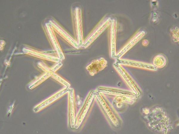 Asterionella is a pennate diatom with a single spike appendage that forms circular chains. Thalassiosira is a centric diatom that forms straight chains.