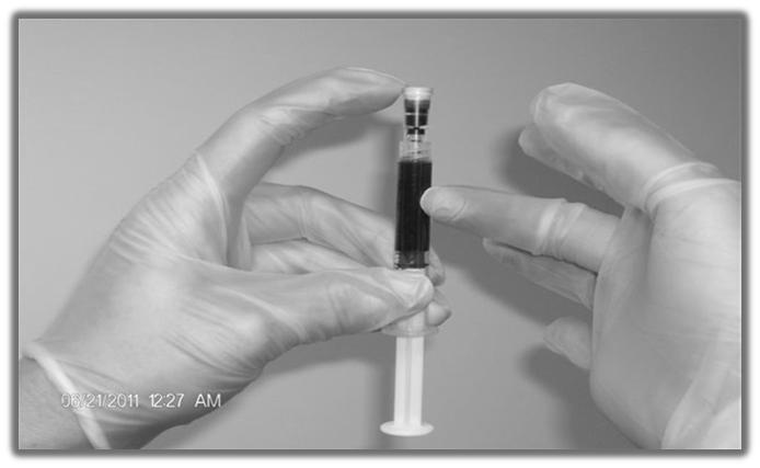 Specimen Preparation Tapping the syringe, or