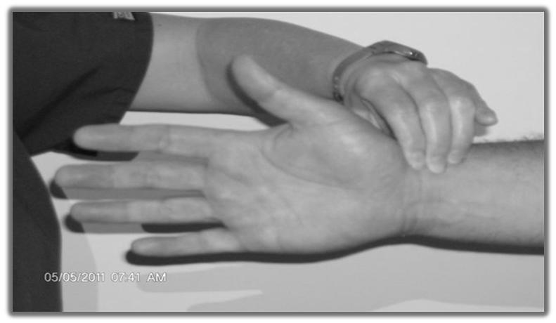 2017 MFMER slide-15 Allen s Test Instruct the patient to open his/her hand and then release the