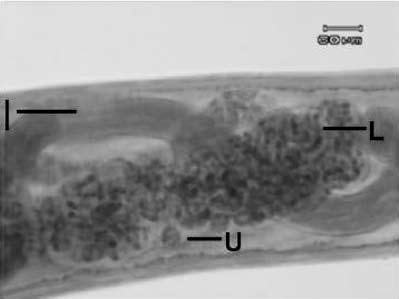 Anisakids in coastal marine fish, chon buri (Fig 2). The cuticle parts were transversely striated and translucent.
