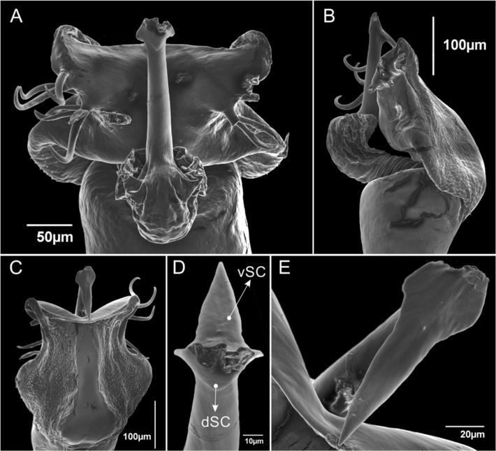 Villarreal M et al. Zoological Studies (2015) 54:45 Page 13 of 18 Figure 12 Ventrifurca caffeinica sp. nov. (MNRJ 7038). Penis, distal part. (A) Dorsoapical view. (B) Lateral view. (C) Ventral view.