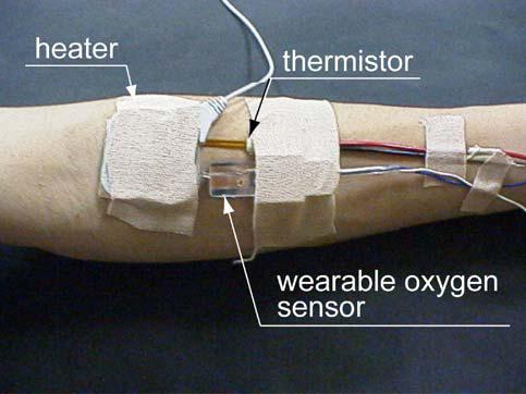 7 The position of an electrochemical sensor at monitoring of transcutaneous gas composition Photo of the sensor attachment on the forearm skin.