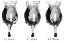 Running head: Impact of heel position on leg muscles during walking be a factor that increased or decreased the varusvalgus moment of the ankle joint during the time from IC to TSt, which is why a
