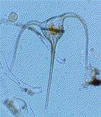 50 Cyanophytes Phytoplankton 0.29 filter -0.19feeding -0.25 Diatoms 0.79 0.51 0.09-0.