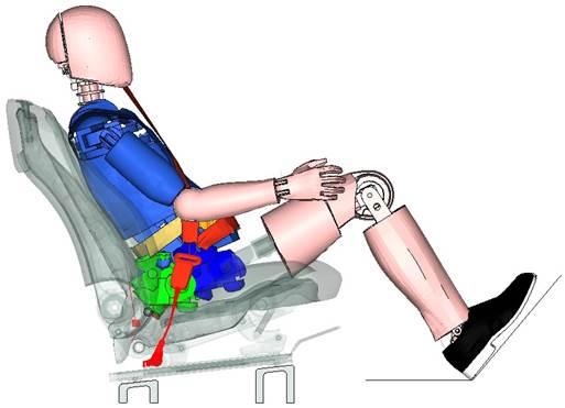 Standard position: low risk of submarining (Hx) Initial pelvis position: green Fig. 3.