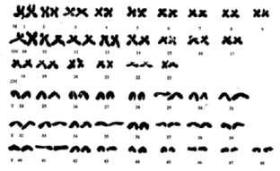 Figure 4: Karyotype of Snow trout (Schizothorax richardsonii) 4 DISCUSSION The chromosomal studies revealed that the diploid chromosome number in Rainbow trout (Onchorhynchus mykiss) and Snow trout