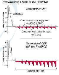 Take a look at the graph above comparing the pressures inside the chest during CPR when a ResQPOD is in place, to conventional CPR without the use of a ResQPOD.