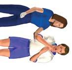 Approach Mild airway obstruction player able to speak, cough and breathe and potentially able to clear blockage.