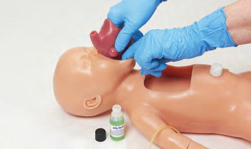 4. Push the tube end of the airway into the baby s mouth. Slide the airway down into the head, making sure to free the baby s lips as it slides into place. (See Figure 3.) 5.