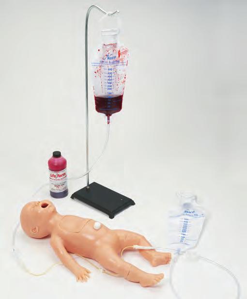 GI The left nostril will accept an 8 FR NG tube that will pass into a small tube embedded in the chest cavity of the baby. General Instructions for Use A. Performing IV Injection and Withdrawals 1.